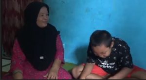 Dibiayai Pemkab Sidoarjo, Anak Penderita Benjolan Mata akan Dioperasi di RSUD Sidoarjo